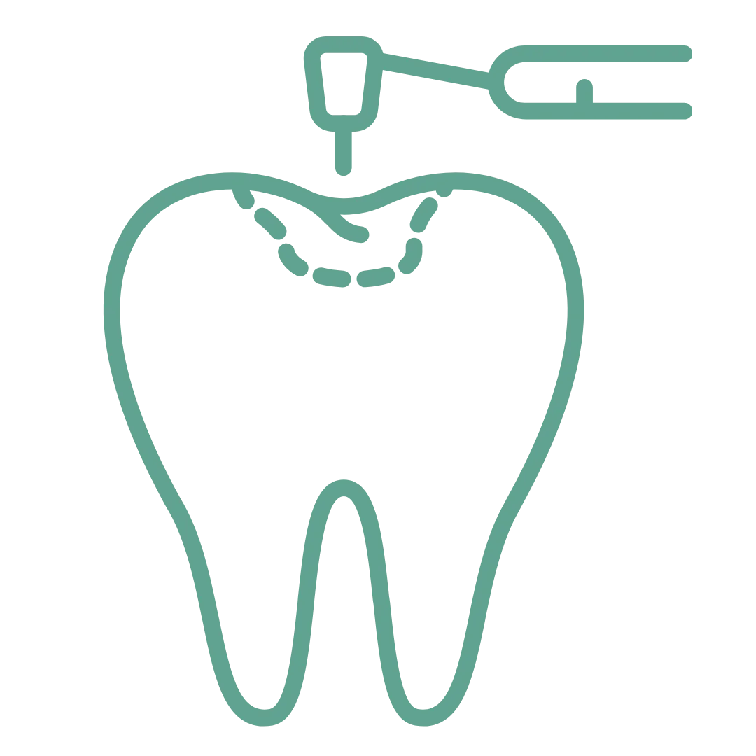 Fillings