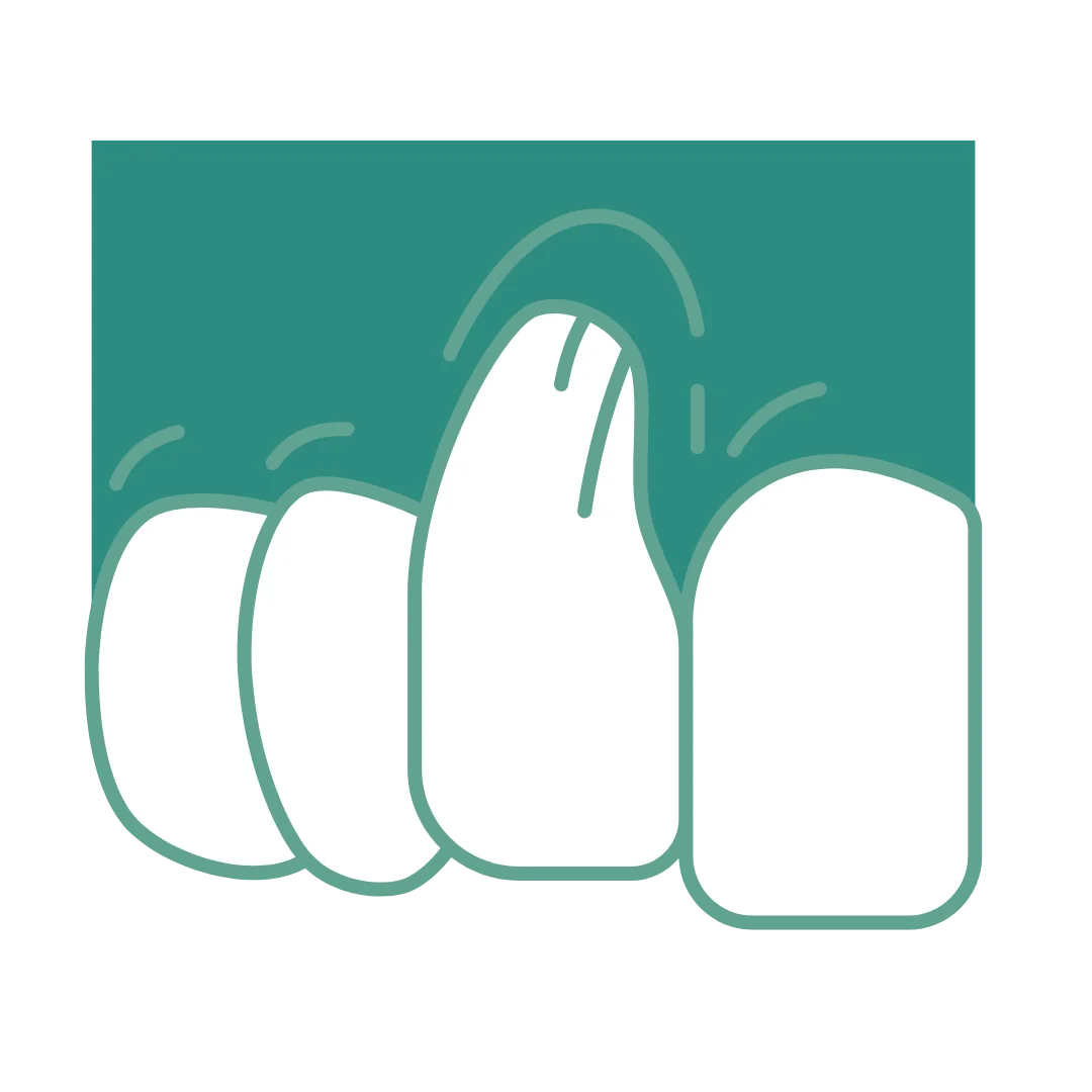 Frenectomy