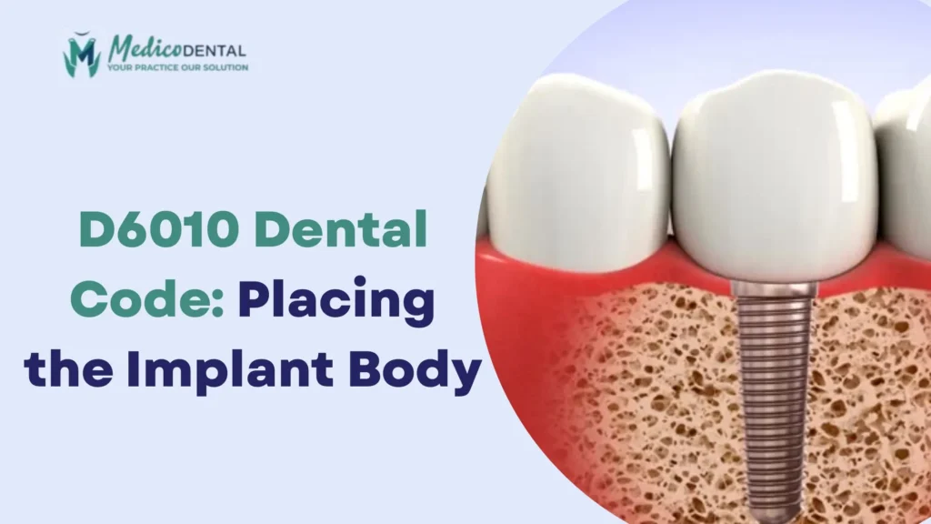 D6010 Dental Code