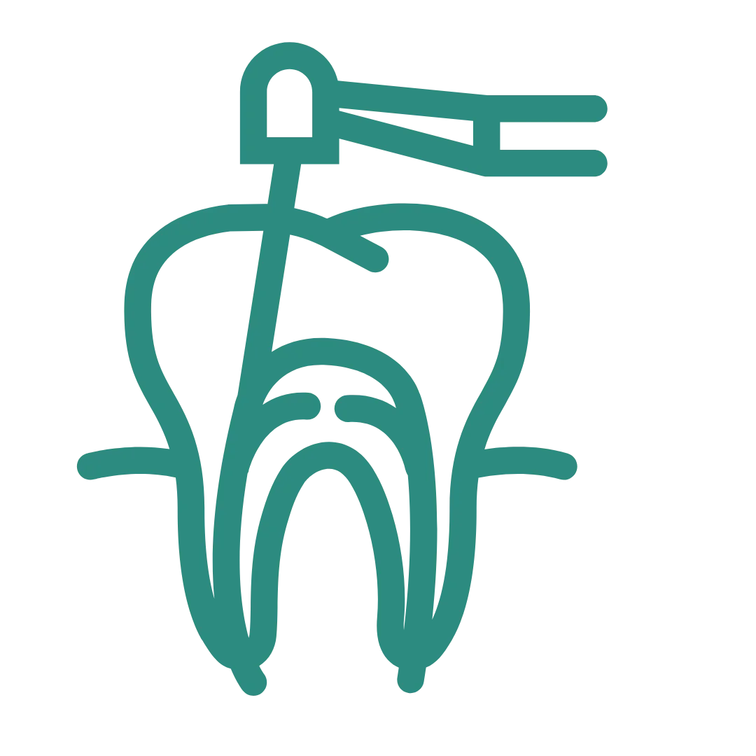 Retreated Root Canals