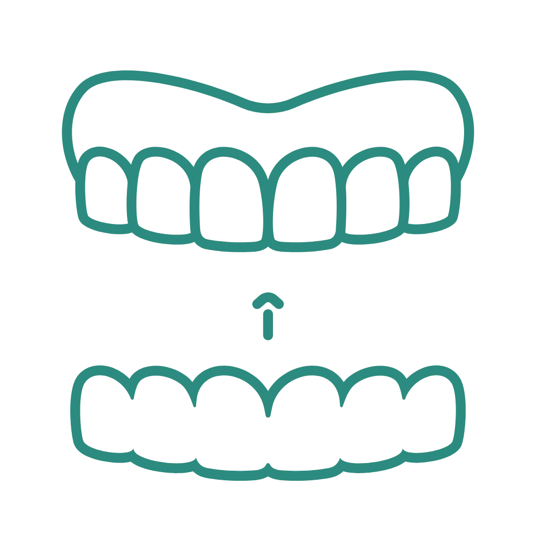 Invisalign or Clear Aligners