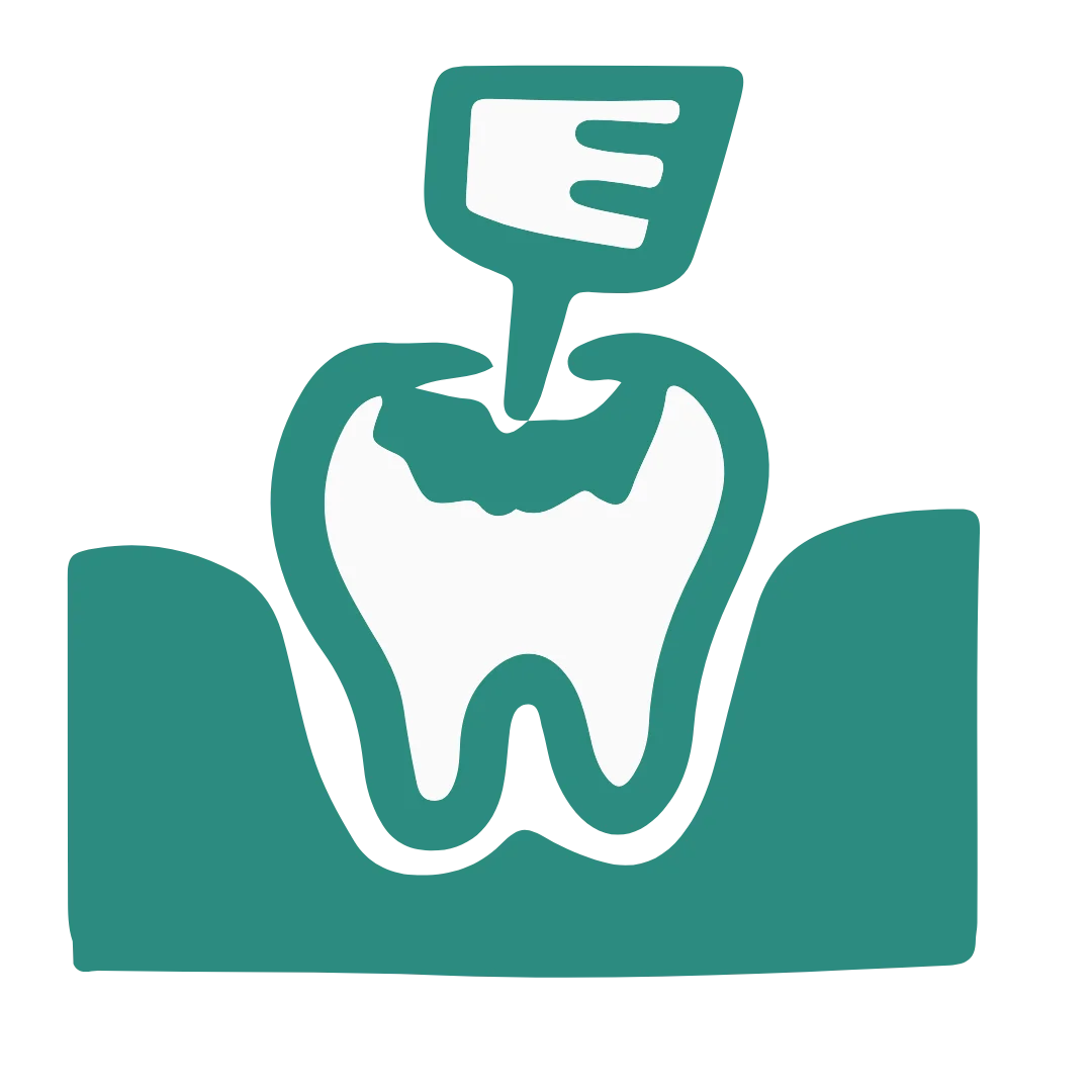 Tooth-Colored Fillings
